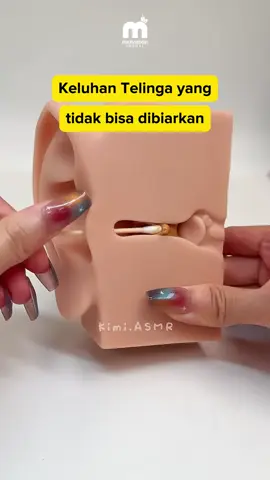 Jangan dibiarkan yaa🙏 #telinga #telingaberdengung #telingakotor #tht #propolissm #viralvideo #fyp