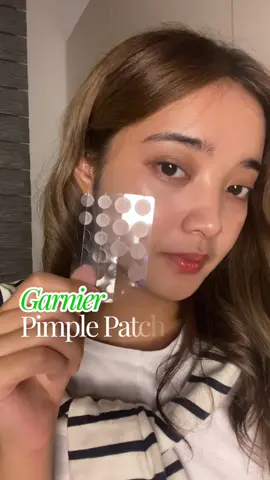 Garnier Pimple Patch for me🥹 #GarnierInsiviblePimplePatch #PatchItOnTheSpot #fyp #foryoupage 