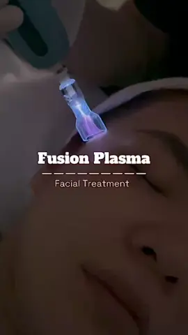 Công nghệ Plasma lạnh mới - tiên phong trong điều trị mụn đã được ứng dụng tại Min Spa #plasma #fusionplasma 