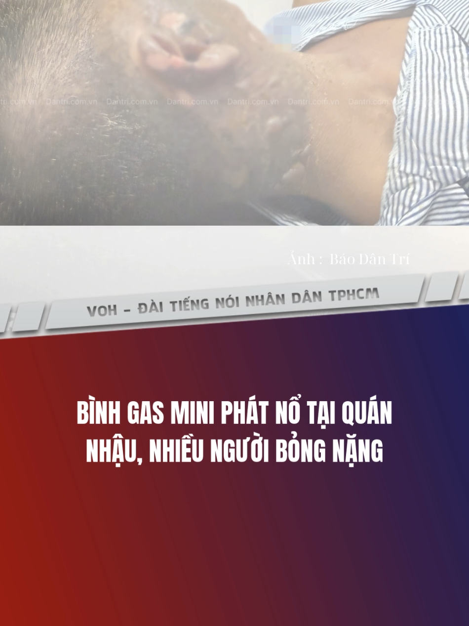 Bình gas mini phát nổ tại quán nhậu, nhiều người bỏng nặng #VOH #tinnhanh #tintuc #radiohcm 