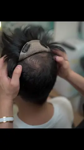 เยี่ยมที่สุด#วิกผมแท้ #วิก #วิกผมชาย #ปิดหัวล้าน #แฮร์พีช 