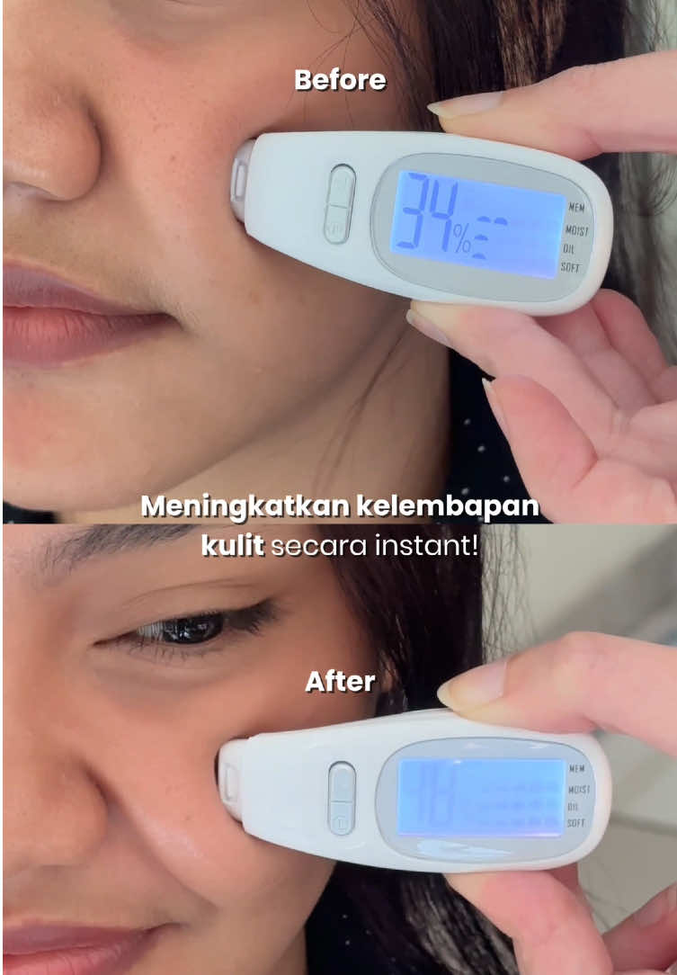 One spray for instant hydration❄️💦 #kulitkering #spray #kulitlembap #fyp 