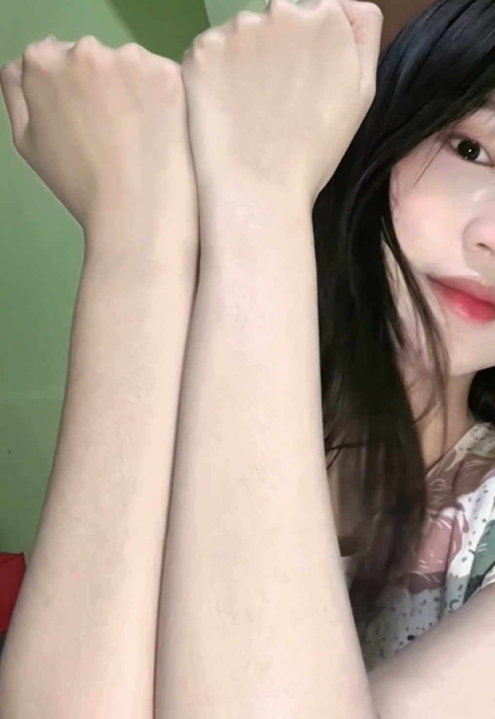 suntik putih? mending pake ini@sculpt.id 