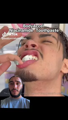 Incroyable ⭐️✨#prt #fyp #dentblanche #dentifrice  #devinelapersonne 