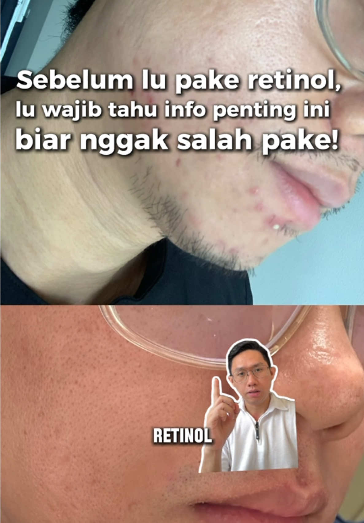 Retinol semagic itu, sayangnya ada beberapa FAKTA yg orang Indonesia mungkin belum tau ! #MoisturaizerGameChanger