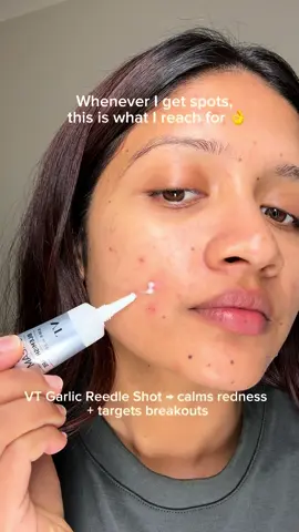 Breakouts aren’t easy… that’s why I keep these for the days my skin needs extra care 🌿✨ @VT Cosmetics US  #vtcosmetics #acnetreatment #vtgarlicreedleshot #acneskin #pimplepatch 