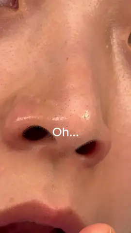 #zerofilm #zerofilmchallenge #enlargedpores #orien