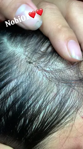 Remove lice #fentysuperbrandday #liceremoval❤️❤️❤️ #lice🥰 #omg😰😱😱 