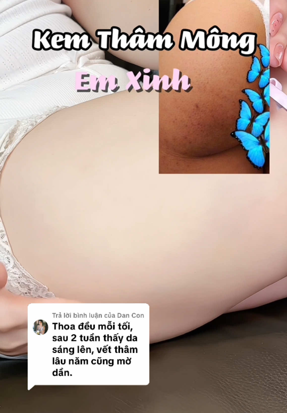 Trả lời @Dan Con  Dành cho chị em muốn sở hữu v3 xinh đẹp #julianganle  #eẽminh #giamtham #duongda 