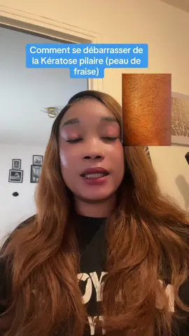 Gel de douche contre la kératose pilaire @radiance secret beauty 