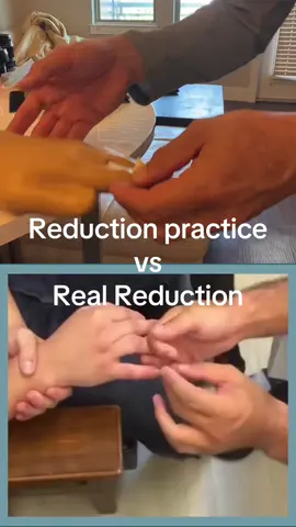 #sportsmedicine #athletictraining #fingerdislocation #medicalsimulation #foryou @DoctorJesss @Alert Services @Dr. Siya, MD @Sean Thompson @Dr Giovanni Bonfanti DO 