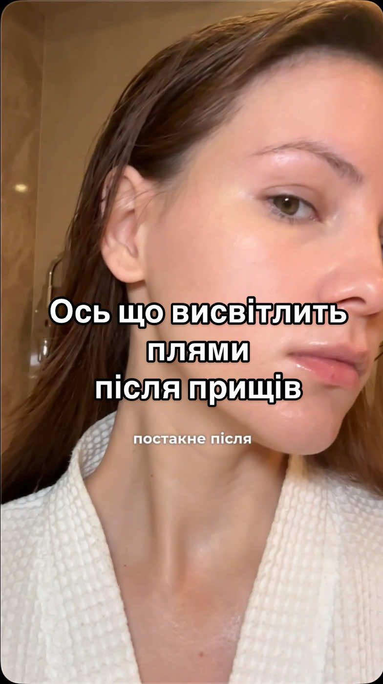 В мене тонка шкіра і завжди зʼявляються застійні плями після прищів. Якщо одразу з ними працювати - все швидко проходить) Cosibella: пєди 19649, крем: 23166 #догляд #освітленняшкіри #постакне #косметика #пігментація 