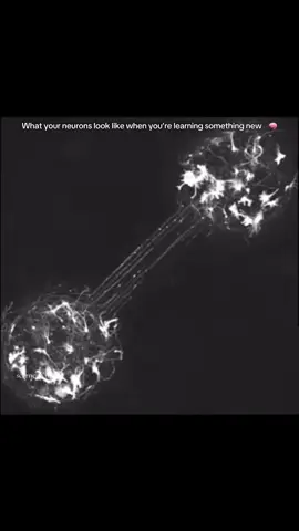 Neurons under a microscope 🧠✨##medicine##neurology##neurologist##biology##fypシ
