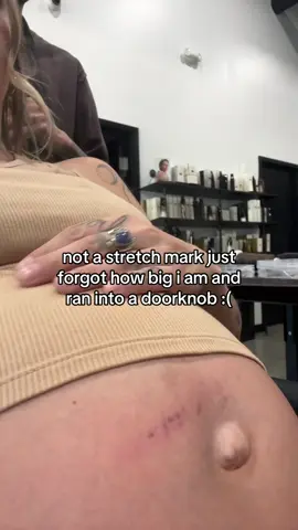 my spatial awareness is off :( #fyp #pregnant #maternity #stretchmarks 