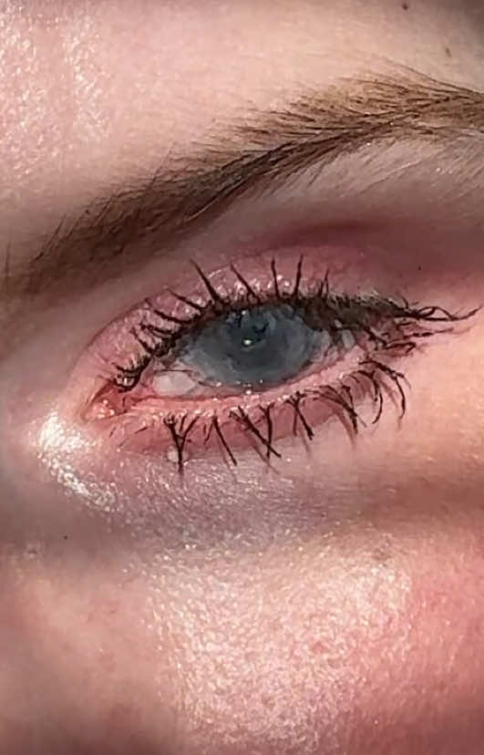 it’s taken me so long to be okay with having eyes that look different. Only recently did I start to believe they’re pretty cool. Their scars are a testament to their strength.  What color would you say they are? I usually say my right is light blue/grey but my other one gets mixed opinions.  #heterochromia #eyes #glaucoma #uveitis #lowvision 