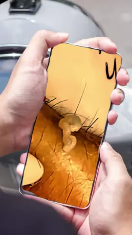 #squeezeyuk #satysfying #pimple #foryou #relax #acne 