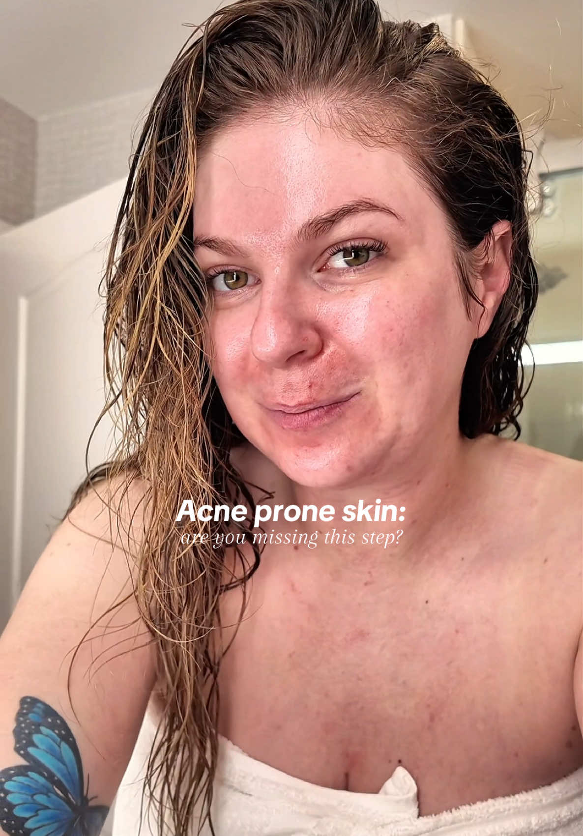 Ceramides are essential to barrier repair— pick a moisturize that can repair the barrier after acne effected it #acneproneskin #ceramides #ceramidemoisturizer #barrierrepair #alpynbeauty @Alpyn Beauty 