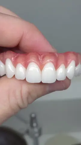 Với sứ mệnh phục hình nụ cười mới, Digital luôn đồng hành cùng quý nha sĩ để mang lại giải pháp tối ưu, chuẩn xác và hiện đại nhất. 💎 Không chỉ là kỹ thuật, chúng tôi mong muốn gửi gắm cảm xúc – sự tự tin – niềm vui đến từng bệnh nhân. 👉 Digital – Giá trị bền vững từ nụ cười trọn vẹn.” #dentistryworld🦷🦷 #xuhuong #tiktokviral #abutment #emax #sángtao #phuchinhrang 