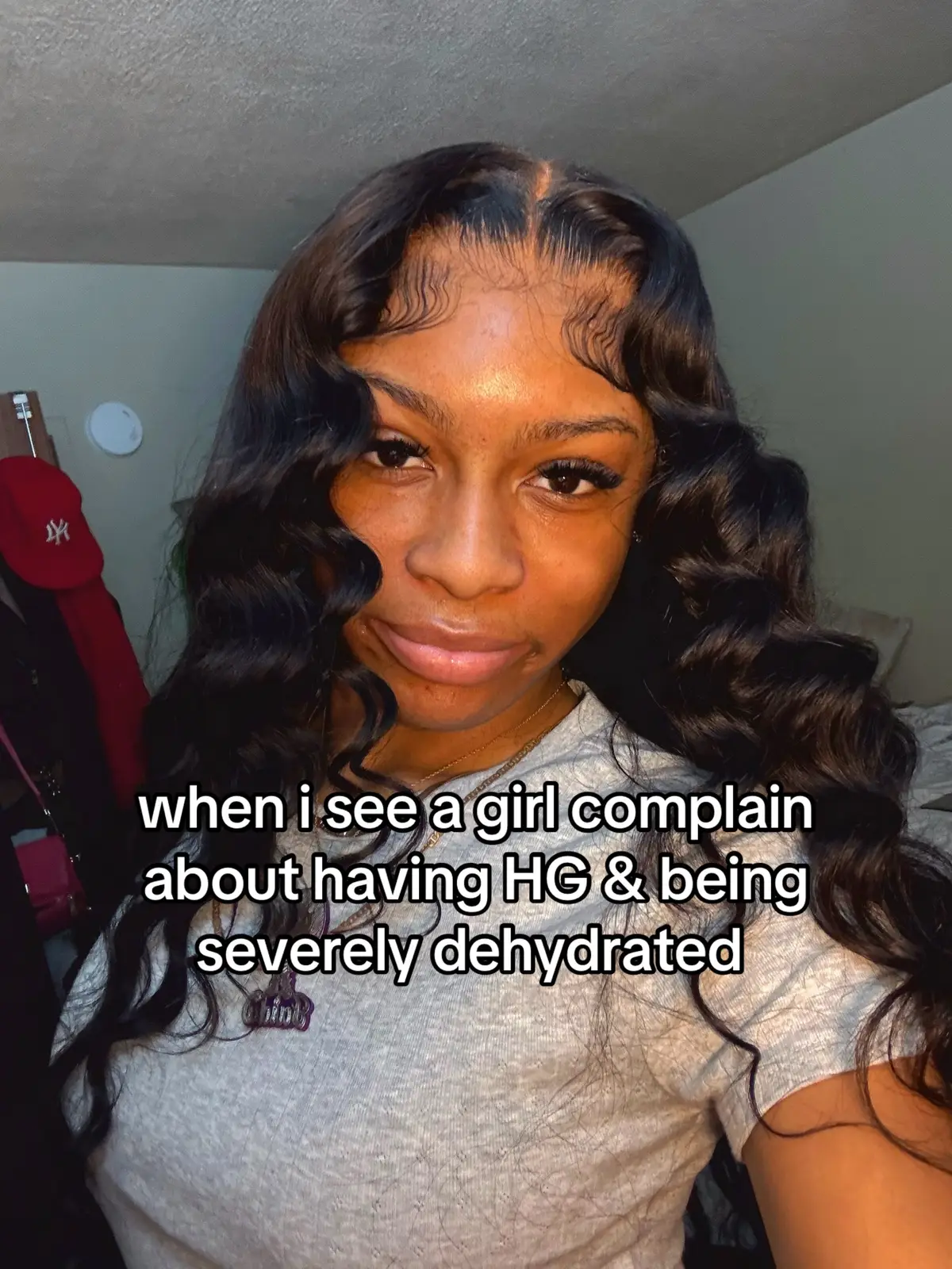 it’s not as bad now tho thank God ! #hyperemesisgravidarum #fypシ 