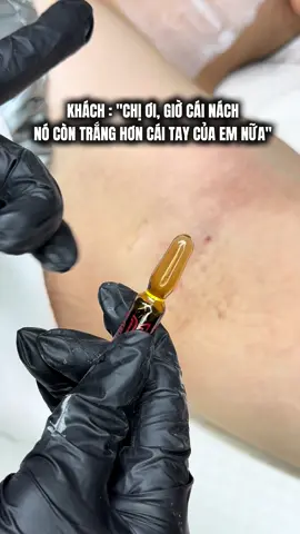 Peel nách gi chưa người đẹp #xhuongtiktok #peelnach 