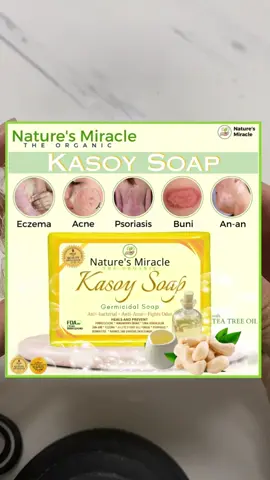 Kasoy Soap‼️ Tanggal ang:  ✅An-an  ✅Buni ✅Alipunga  ✅Hadhad  ✅Psoriasis  ✅Eczema AT MARAMI PANG IBA! TRY NYO NA TO MIMAAA!!  #Alipunga #Tagyawat #Acne #SkinProblems #kati  