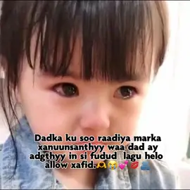 Kuna dhahan caafimdka iga warn.makuwas oo kle.🫶😭💕#alhamdulillah #viewsproblem💔😔 #الشعب_الصيني_ماله_حل😂😂🙋🏻‍♂️ #fyyyyyyyyyyyyyyyy #الشعب_الصيني_ماله_حل😂✌️ 