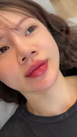 Chị khách bảo tiêm sương sương cho chị thôi, chị thích gu tự nhiên .Oke chị luôn nha 😘😘#filler #tiemmoidep #tiemmoi #tiemfillerdep #tiemmoifiller 