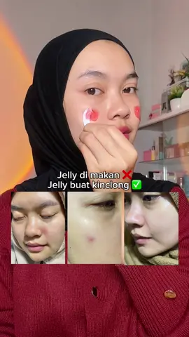 Gokill abis ni diliat liat di jelly ini yah😱🩸🫰🏻 #redjelly #redragon #msglow 