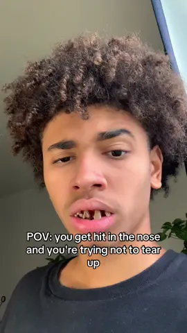 #trend #nose #funny #relatable 