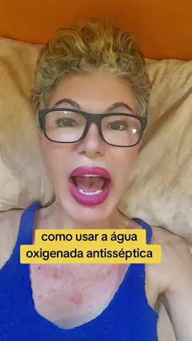 #aguaoxigenada #antisseptico #professoramaisa 