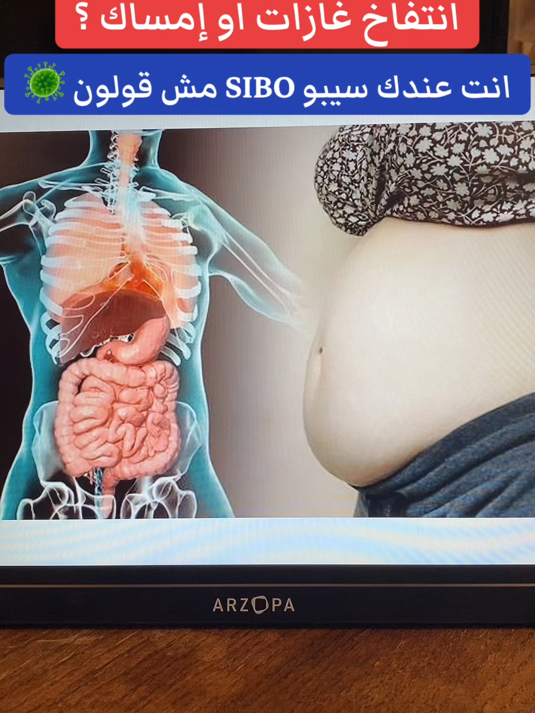 #قولون_تقرحي #إمساك_مزمن #قولون_معدة_غازات_إنتفاخات_إمساك_حموضة #قولون_هضمي #توعية_صحية #السعودية_الكويت #إنتفاخ_البطن #إنتفاخ_القولون #مكة_المكرمة_السعودية #إنتفاخ_البطن_والأمعاء #الرياض_الان #إمساك #قولون #الرياض_الآن🇸🇦🇸🇦