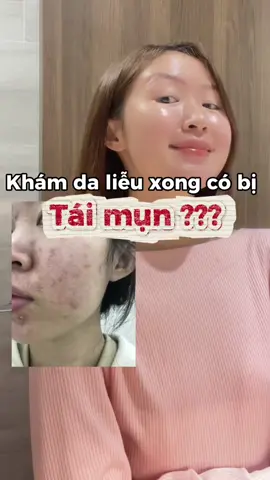 Cách tui chăm da mụn bị tái đi tái lại nhiều lần #effaclar #larocheposaypartner #chamsocda  #TikTokFinds