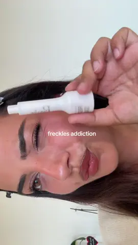 freckles addiction #freckles #tachederousseau #fyp #pourtoi #girls 
