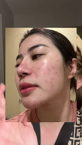 My nightly skincare routine. ☺️