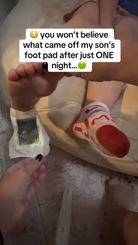 I put these detox foot pads on my son before bed… and the results were shocking. Not only did they pull out toxins, but he slept so deeply and woke up in the best mood. Definitely adding these to our nightly routine 🌙✨ #momlife #detox #bettersleep  #detoxfootpads #sleepbetter   