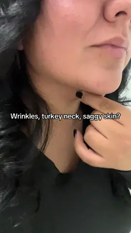 Get rid of your turkey neck! #neckcream #tighteningcream #necktighteningcream #beauty #neckline 