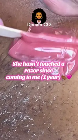 Her hair is SO much thinner now and her complexion has improved so much 🥺🩷 . #denverbrazilianwax #denverwaxer #coloradowaxing #brazilianwax #extractions 