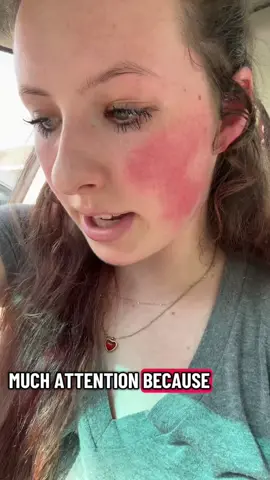 #real #relatable #fypシ #foryoupage 