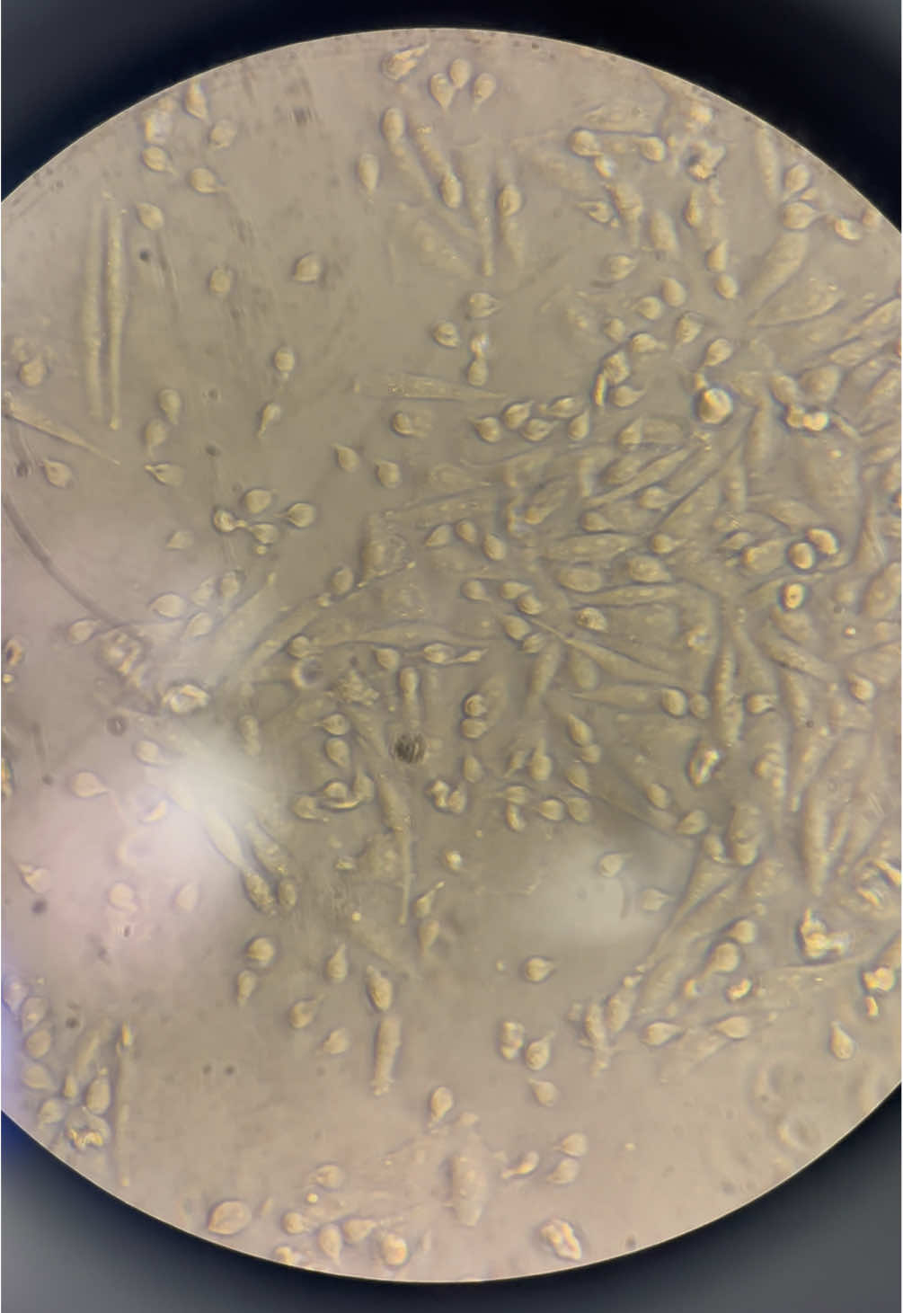 Mais um já que vocês gostaram tanto do outro vídeo…#laboratorio #parasite #cientista #biomedicina #microscope 