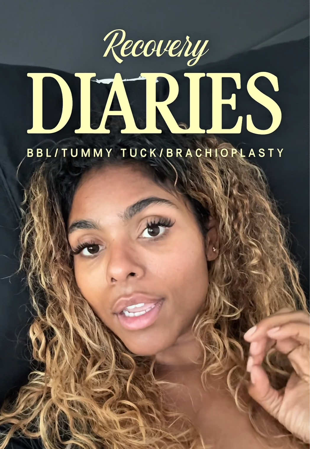 RECOVERY DIARIES PT 1.   About my BBL and skin removal post- 90 lb weight loss! have questions? Let me know!!! I wanna share as much as possible about this process now that I’m feeling more alert and energetic lol #bbl #bbljourney #plasticsurgery 