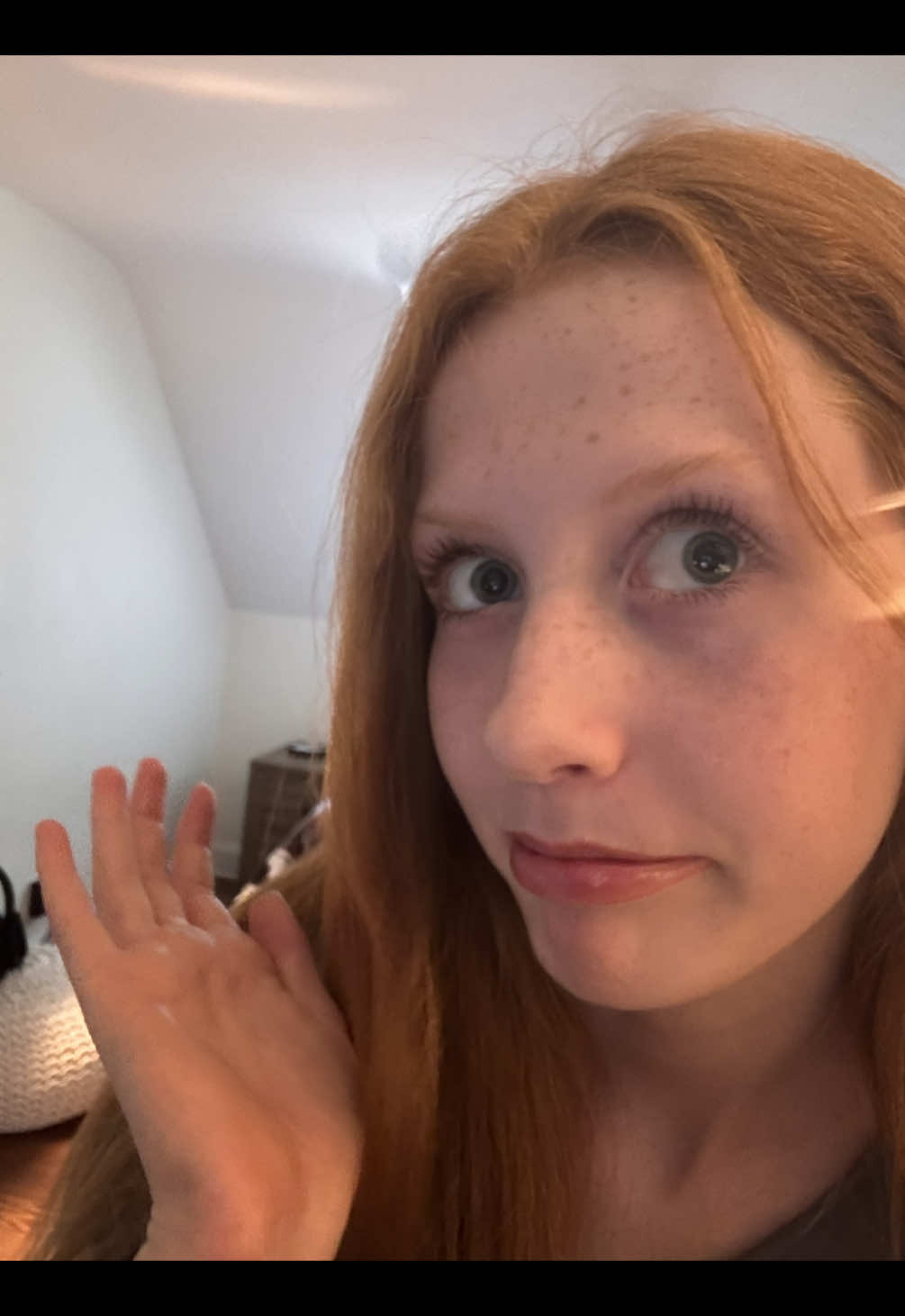 ummm so i got hit by a tailgate, bit by a dog, bit through my lip, and ran into the wall of a pool… all shown on my face