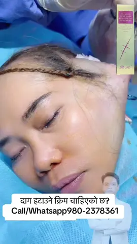 #foryou #scar #operation #stretchmarks #viralvideo 