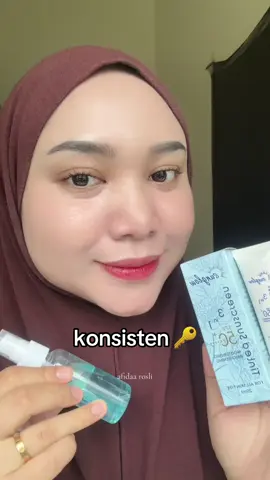 “muka hitam tangan putih” psai burn kusam bagai, sampai muka cerah dh skrg 🤭 #foryou 