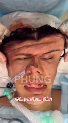 Xem kết quả #trend #xuhuong #nhacnentiktok #drlyminhphung #lyminhphung 