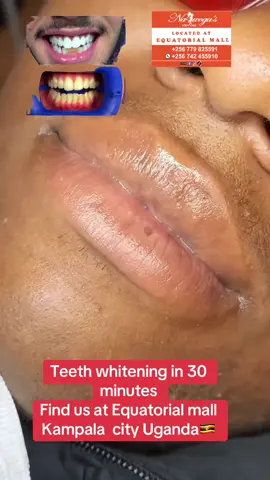 #trendingvideo #kampala_tiktokers #foryou #kampala_uganda🇺🇬🇺🇬🤝 