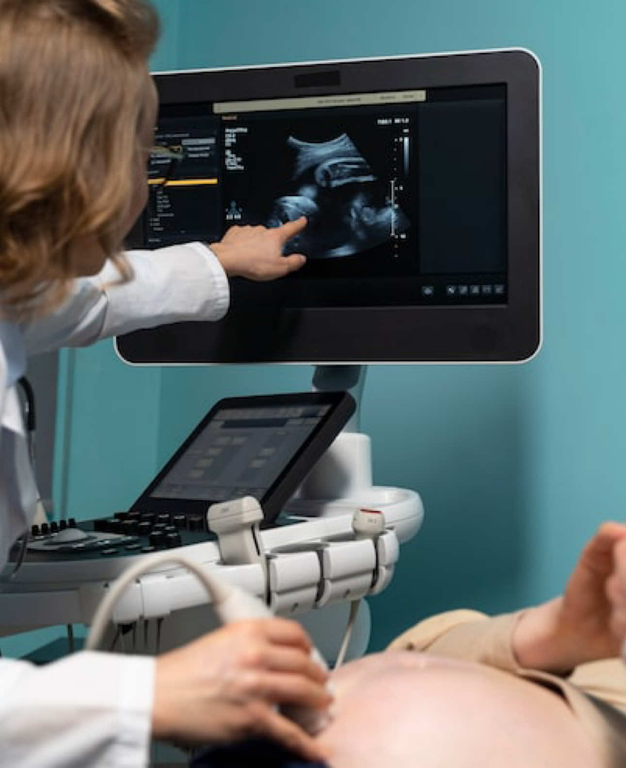 Sony ultrasound upp 110 #sony #ultrasound #sony110 #azerbaijan 