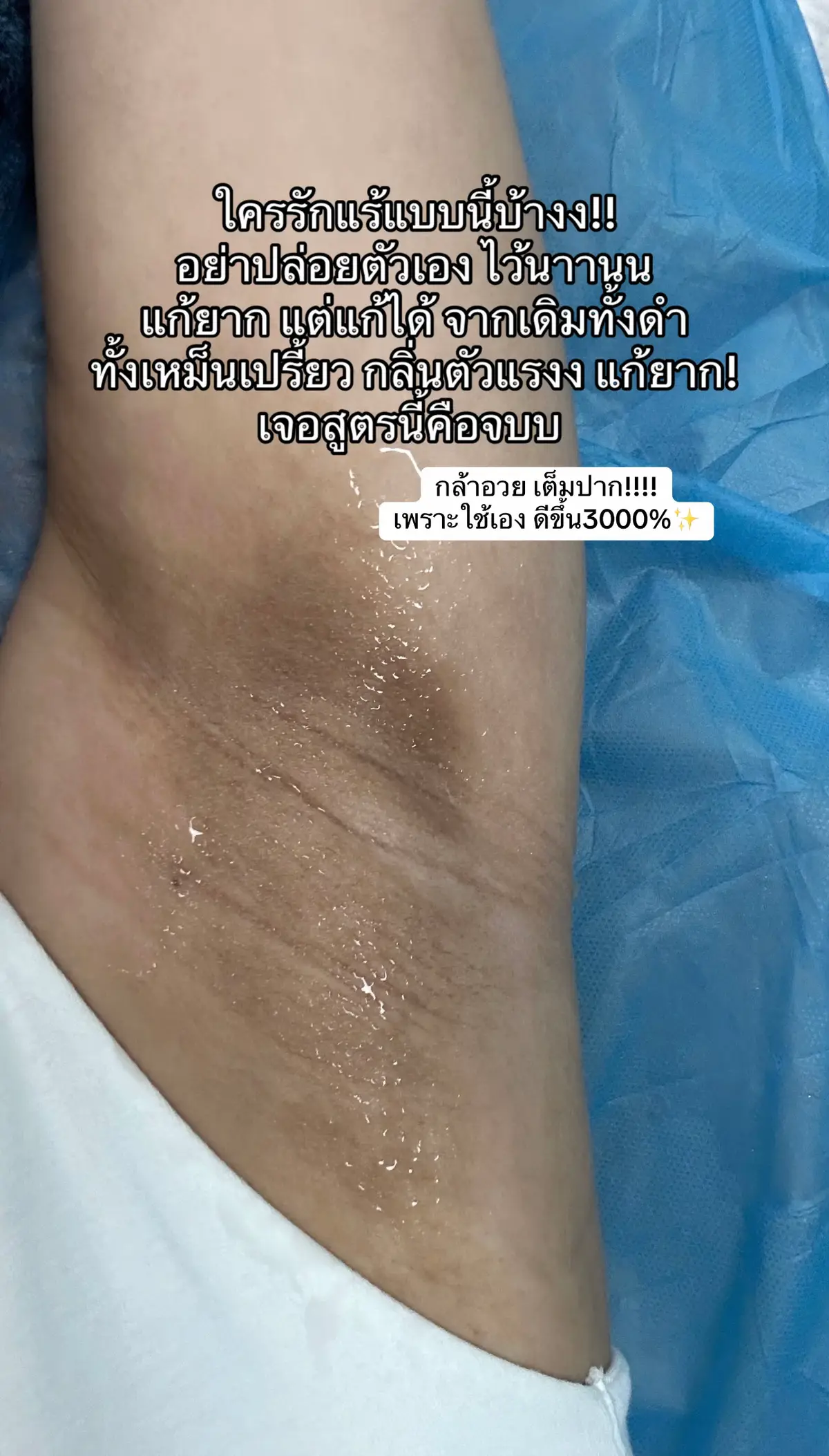 #ครีมรักแร้คามู #ใช้ดีบอกต่อ 
