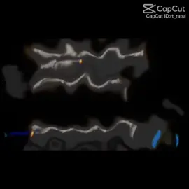 #কেমন_হয়েছে_কমেন্ট_করো #একবার_ও_কি_foryou_পাবো_না🥺 @Hey Toma Yt 