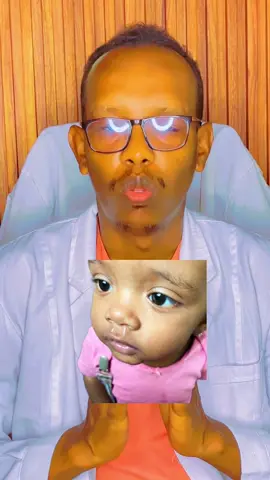 Part-202 XASAASIYADA SANKA#somalitiktok #USA #europe #fyp #UK 