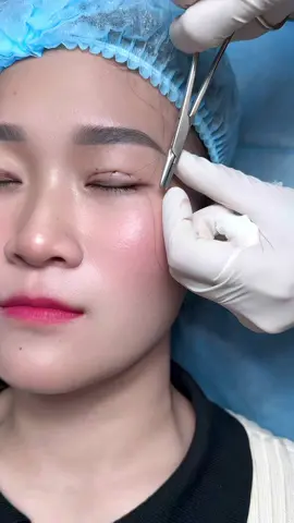 Lại nhấn mí #nhanmidepdalat #xuhuong #nhanmitunhien 